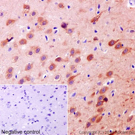 Immunohistochemistry (Formalin/PFA-fixed paraffin-embedded sections) - Anti-PYK2 antibody [YE353] - BSA and Azide free (AB228477)