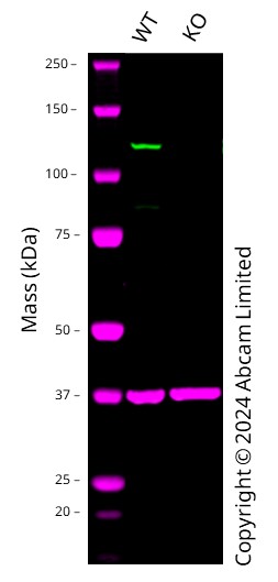 Western blot - Anti-PYK2 antibody [YE353] - BSA and Azide free (ab228477), expandable thumbnail