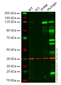 Western blot - Anti-PYK2 antibody [YE353] - BSA and Azide free (AB228477)