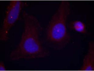 Immunocytochemistry/ Immunofluorescence - Anti-PYK2 (phospho Y402) antibody (AB131543), expandable thumbnail