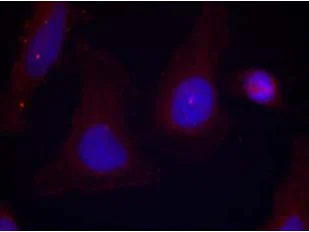 Immunocytochemistry/ Immunofluorescence - Anti-PYK2 (phospho Y402) antibody (AB131543)