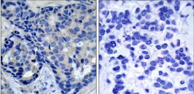 Immunohistochemistry (Formalin/PFA-fixed paraffin-embedded sections) - Anti-PYK2 (phospho Y402) antibody (AB131543), expandable thumbnail