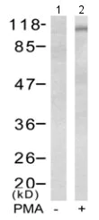 Western blot - Anti-PYK2 (phospho Y402) antibody (AB131543)