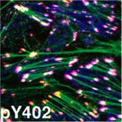 Immunocytochemistry/ Immunofluorescence - Anti-PYK2 (phospho Y402) antibody (AB4800)