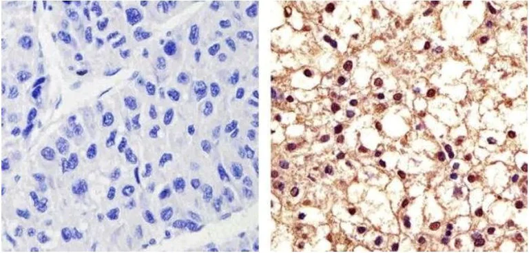 Immunohistochemistry (Formalin/PFA-fixed paraffin-embedded sections) - Anti-PYK2 (phospho Y402) antibody (AB4800)