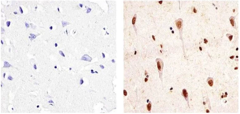 Immunohistochemistry (Formalin/PFA-fixed paraffin-embedded sections) - Anti-PYK2 (phospho Y402) antibody (AB4800)