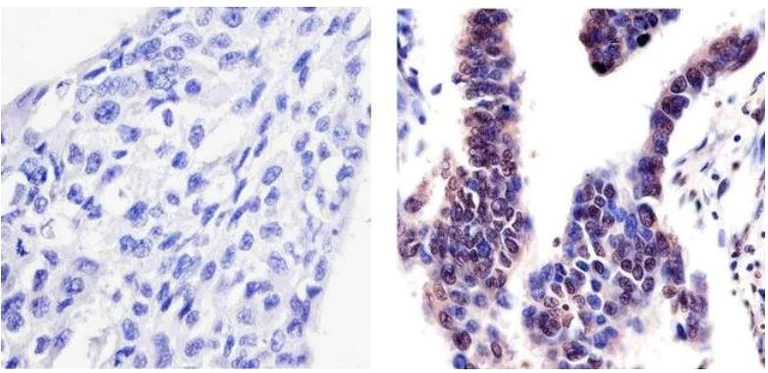 Immunohistochemistry (Formalin/PFA-fixed paraffin-embedded sections) - Anti-PYK2 (phospho Y402) antibody (AB4800)
