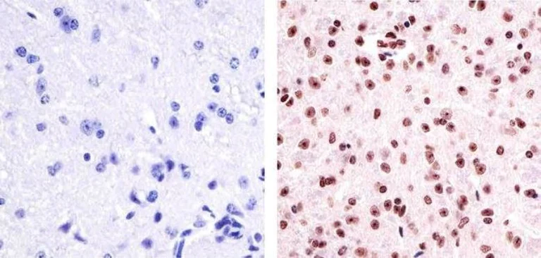 Immunohistochemistry (Formalin/PFA-fixed paraffin-embedded sections) - Anti-PYK2 (phospho Y402) antibody (AB4800)