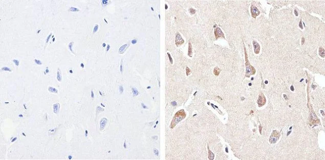 Immunohistochemistry paraffin embedded sections - Anti-PYK2 (phospho Y402) antibody [RP23040011] (AB307990)