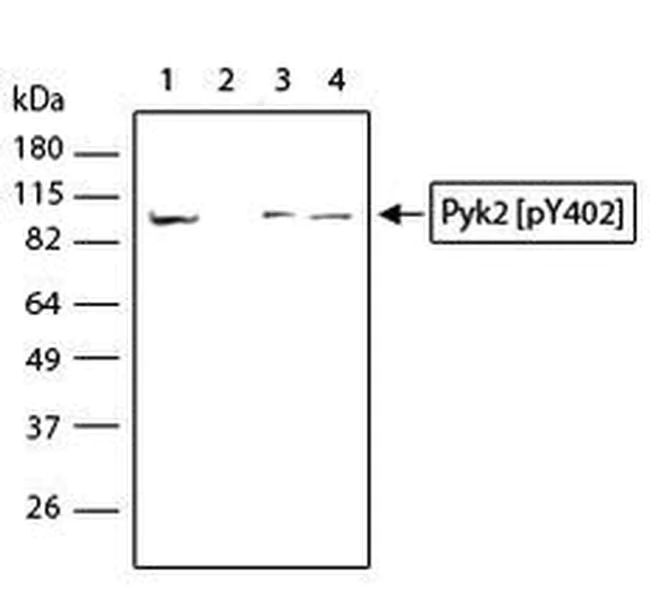 Western blot - Anti-PYK2 (phospho Y402) antibody [RP23040011] (AB307990)