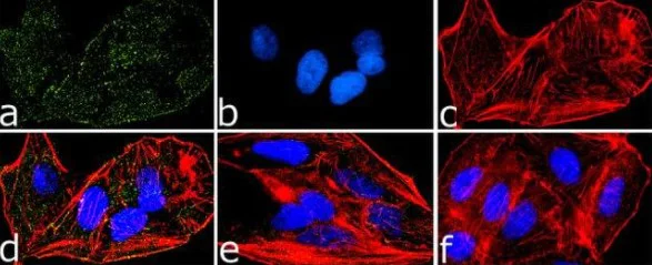 Immunocytochemistry - Anti-PYK2 (phospho Y579 + Y580) antibody (AB4807)