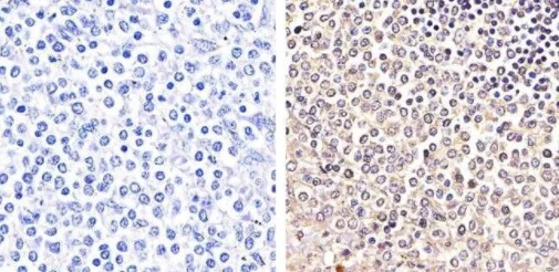 Immunohistochemistry (Formalin/PFA-fixed paraffin-embedded sections) - Anti-PYK2 (phospho Y579 + Y580) antibody (AB4807)