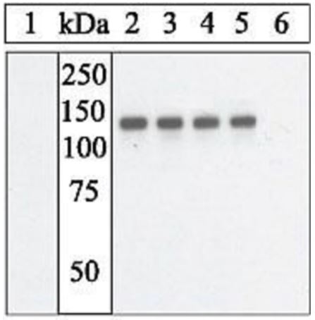 Western blot - Anti-PYK2 (phospho Y881) antibody (AB4801)