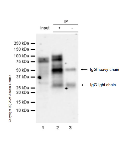 Immunoprecipitation - Anti-Pyrin antibody [EPR18675] (AB214772)