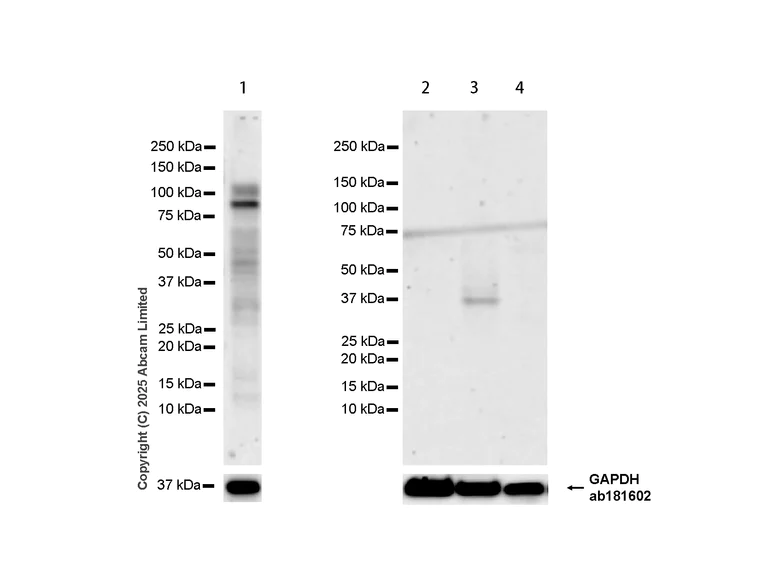 Western blot - Anti-Pyrin antibody [EPR18675] (AB214772)