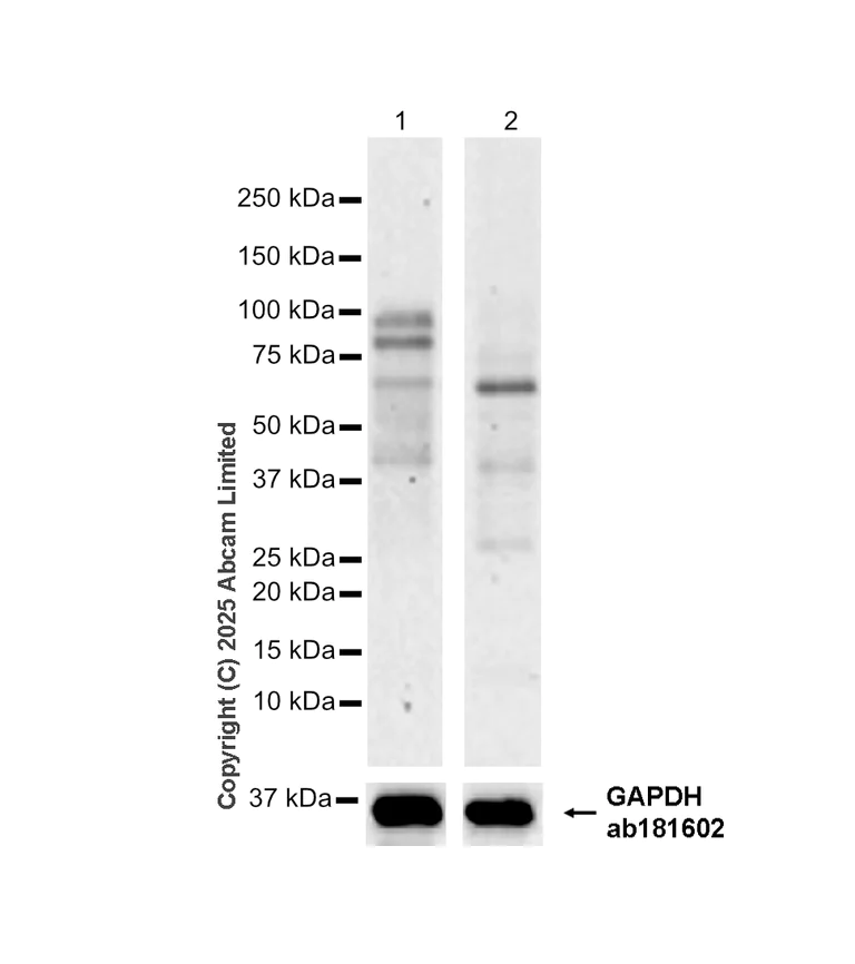Western blot - Anti-Pyrin antibody [EPR18675] (AB214772)