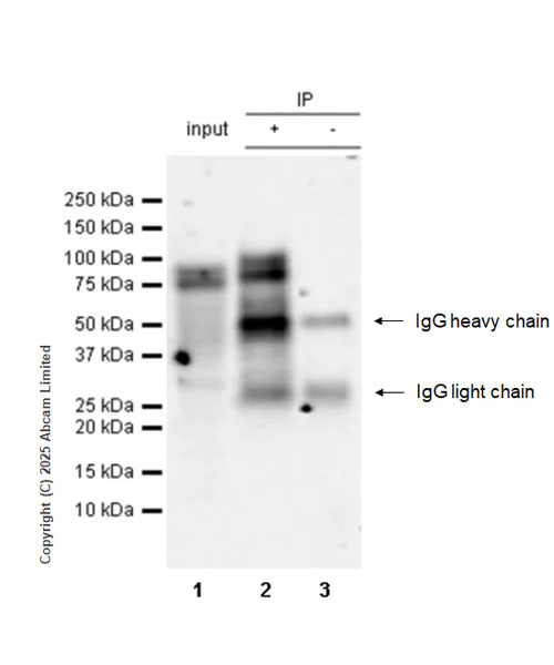 Immunoprecipitation - Anti-Pyrin antibody [EPR18675] - BSA and Azide free (AB223132)