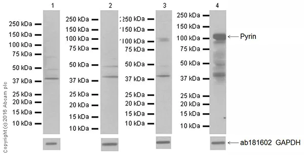 Western blot - Anti-Pyrin antibody [EPR18675] - BSA and Azide free (AB223132)