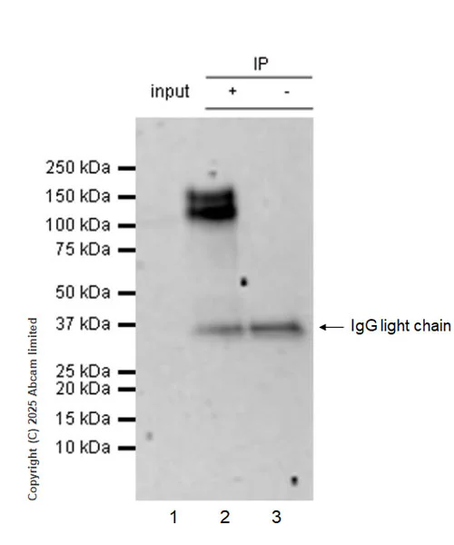 Immunoprecipitation - Anti-Pyrin antibody [EPR18676] (AB195975)