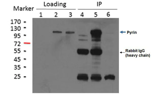 Immunoprecipitation - Anti-Pyrin antibody [EPR18676] (AB195975)