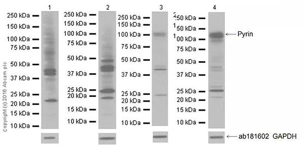 Western blot - Anti-Pyrin antibody [EPR18676] (AB195975)
