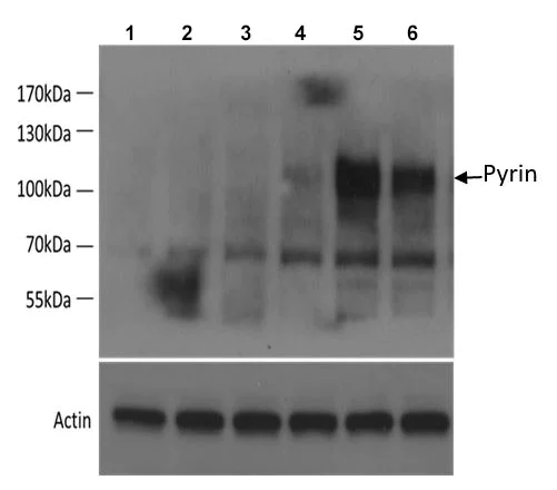 Western blot - Anti-Pyrin antibody [EPR18676] (AB195975)
