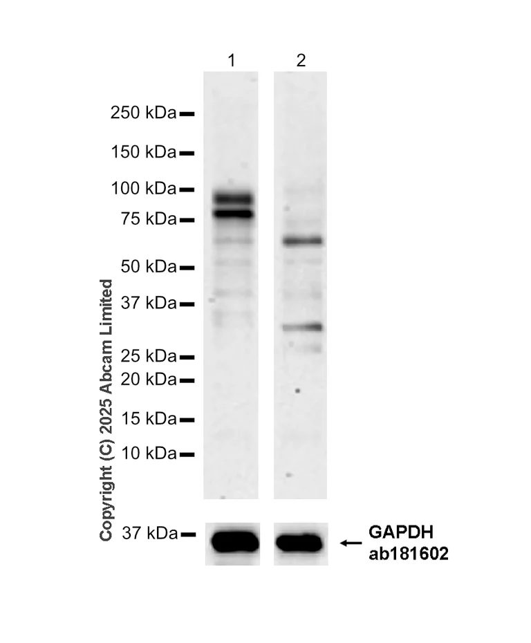 Western blot - Anti-Pyrin antibody [EPR18676] (AB195975)