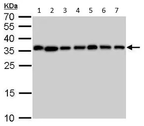Western blot - Anti-Pyrophosphatase 1 antibody (AB96099)
