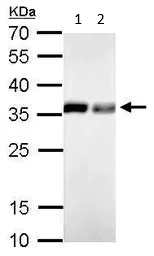 Western blot - Anti-Pyrophosphatase 1 antibody (AB96099)