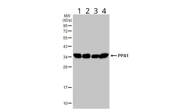 Western blot - Anti-Pyrophosphatase 1 antibody (AB96099)