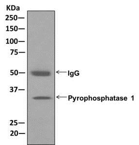 Immunoprecipitation - Anti-Pyrophosphatase 1 antibody [EPR11281] (AB175223), expandable thumbnail
