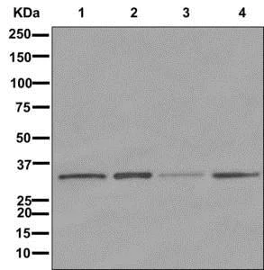 Western blot - Anti-Pyrophosphatase 1 antibody [EPR11281] (AB175223)
