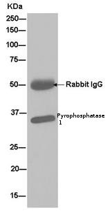 Immunoprecipitation - Anti-Pyrophosphatase 1 antibody [EPR11282] - BSA and Azide free (AB250366), expandable thumbnail