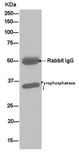 Immunoprecipitation - Anti-Pyrophosphatase 1 antibody [EPR11282] - BSA and Azide free (AB250366)