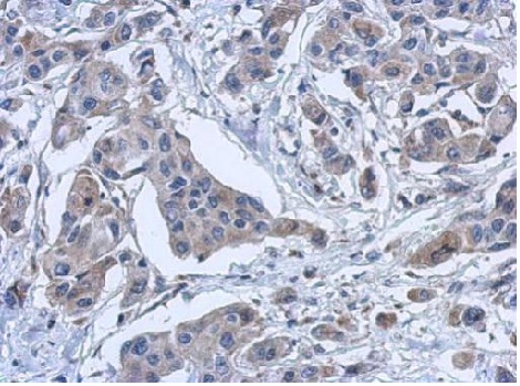 Immunohistochemistry (Formalin/PFA-fixed paraffin-embedded sections) - Anti-PYROXD2 antibody (AB228998), expandable thumbnail