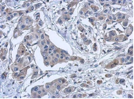 Immunohistochemistry (Formalin/PFA-fixed paraffin-embedded sections) - Anti-PYROXD2 antibody (AB228998)