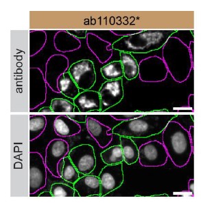 Immunocytochemistry/ Immunofluorescence - Anti-Pyruvate Dehydrogenase E2 antibody [15D3G9C11] (AB110332)