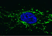 Immunocytochemistry/ Immunofluorescence - Anti-Pyruvate Dehydrogenase E2 antibody [15D3G9C11] (AB110332)