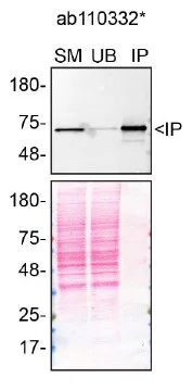Immunoprecipitation - Anti-Pyruvate Dehydrogenase E2 antibody [15D3G9C11] (AB110332)