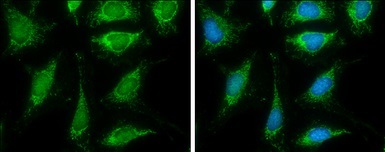 Immunocytochemistry/ Immunofluorescence - Anti-Pyruvate Dehydrogenase E2 antibody (AB126224)