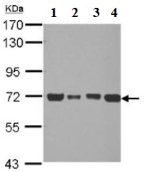 Western blot - Anti-Pyruvate Dehydrogenase E2 antibody (AB126224)