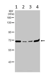 Western blot - Anti-Pyruvate Dehydrogenase E2 antibody (AB126224)