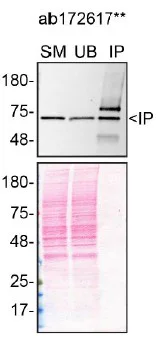 Immunoprecipitation - Anti-Pyruvate Dehydrogenase E2 antibody [EPR12455(B)] (AB172617)