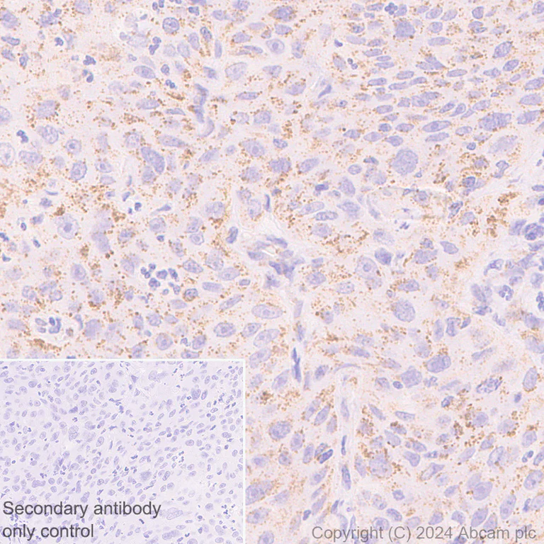 Immunohistochemistry (Formalin/PFA-fixed paraffin-embedded sections) - Anti-Pyruvate Dehydrogenase E2 antibody [EPR12455(B)] - BSA and Azide free (AB240168)