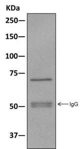 Immunoprecipitation - Anti-Pyruvate Dehydrogenase E2 antibody [EPR12455(B)] - BSA and Azide free (AB240168)