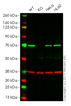 Western blot - Anti-Pyruvate dehydrogenase E2/E3bp antibody [13G2AE2BH5] (AB110333), expandable thumbnail