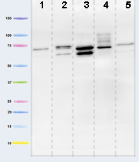 Western blot - Anti-Pyruvate dehydrogenase E2/E3bp antibody [13G2AE2BH5] (AB110333), expandable thumbnail