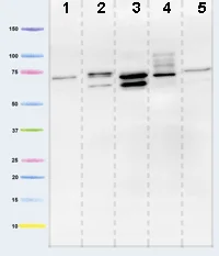 Western blot - Anti-Pyruvate dehydrogenase E2/E3bp antibody [13G2AE2BH5] (AB110333)