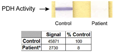 Functional Studies - Pyruvate dehydrogenase (PDH) Enzyme Activity Dipstick Assay Kit (AB109882)