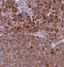 Immunohistochemistry (Formalin/PFA-fixed paraffin-embedded sections) - Anti-PZP antibody (AB122718), expandable thumbnail